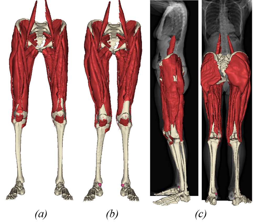 Scaling of the musculoskeletal model.